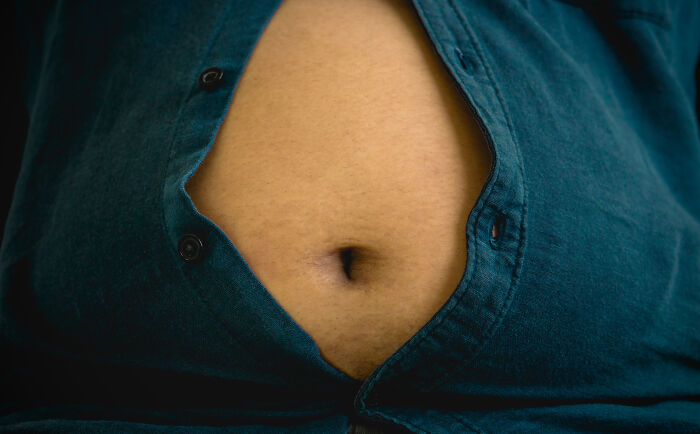 “Imagine The Smell”: 45 Weirdest Objects Doctors Had To Remove From Their Patients