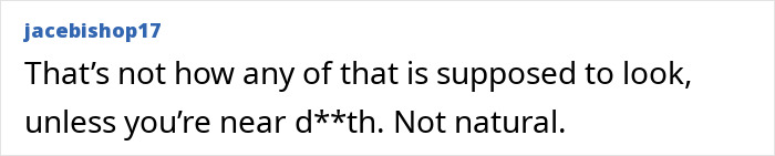 Comment from user jacebishop17 criticizing Photoshop blunder in new bikini pic of top model Kelly Gale. Comment from user jacebishop17 criticizing Photoshop blunder in new bikini pic of top model Kelly Gale.