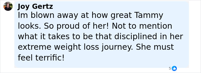 Comment praising Tammy Slaton’s skin removal surgery results and her disciplined weight loss journey. Comment praising Tammy Slaton’s skin removal surgery results and her disciplined weight loss journey.