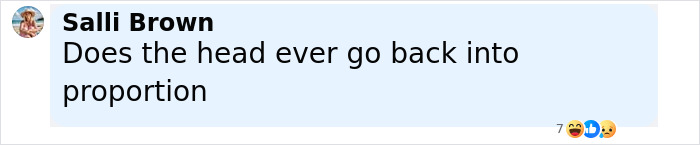 Tammy Slaton from 1000-Lb Sisters showing off her skin removal surgery results, appearing barely recognizable. Tammy Slaton from 1000-Lb Sisters showing off her skin removal surgery results, appearing barely recognizable.