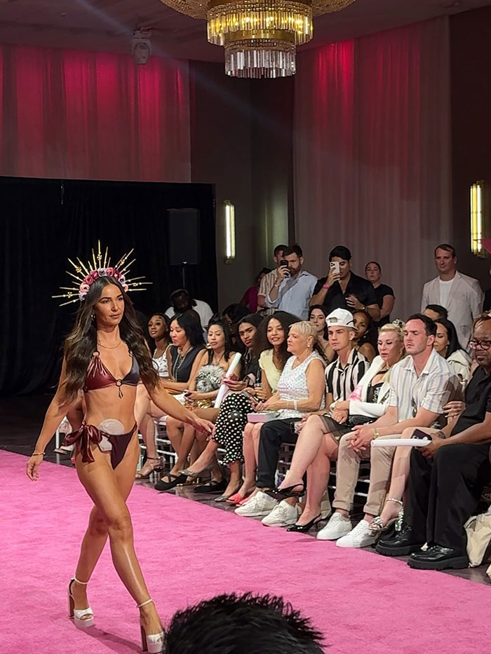 Woman confidently walking runway in bikini showing ostomy bag at fashion show with audience watching and taking photos. Woman confidently walking runway in bikini showing ostomy bag at fashion show with audience watching and taking photos.