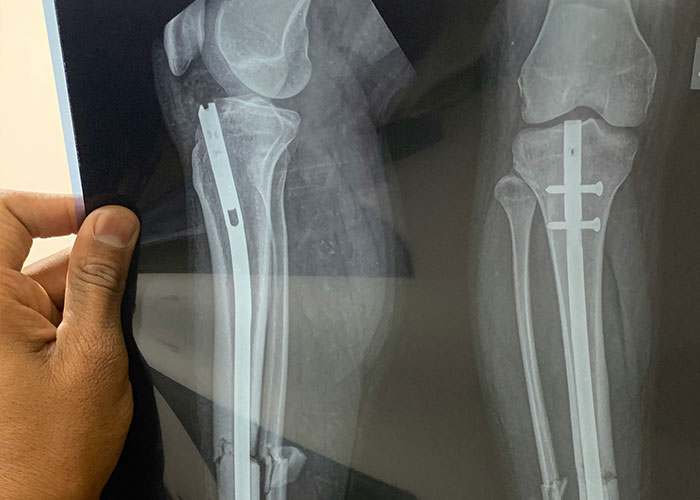 "Surgeons: What Weird Facts Do You Know About The Human Body That You Don't Share With Anybody?"