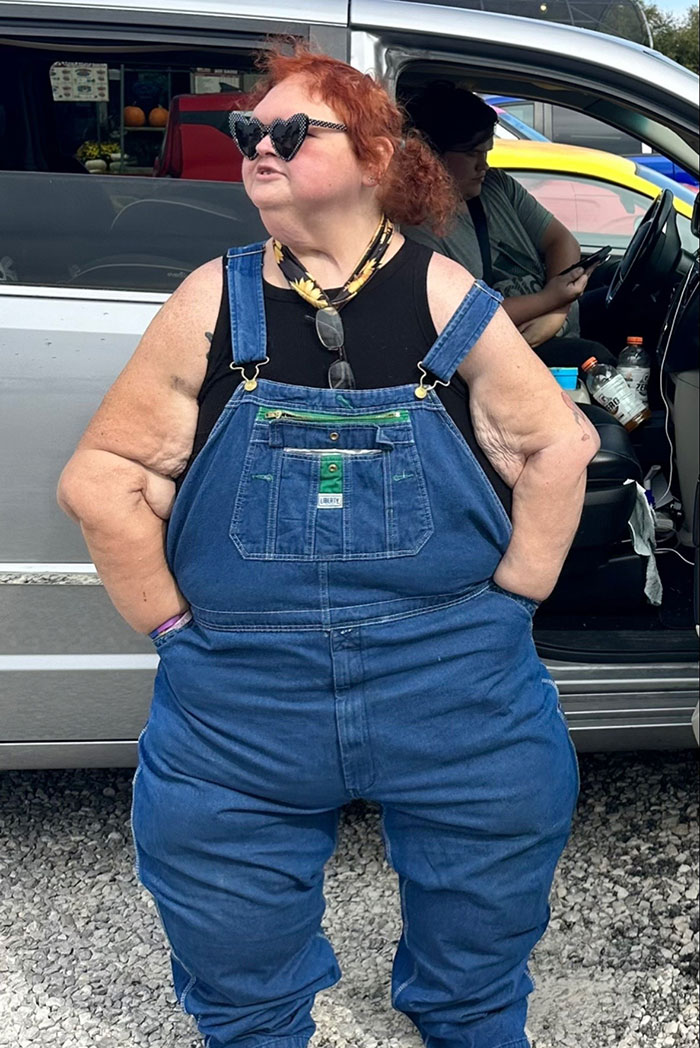 Tammy Slaton from 1000-Lb. Sisters wearing denim overalls and heart-shaped sunglasses outside a vehicle after skin removal surgery results. Tammy Slaton from 1000-Lb. Sisters wearing denim overalls and heart-shaped sunglasses outside a vehicle after skin removal surgery results.