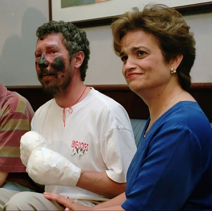 Man with bandaged hands and soot-covered face sits next to woman in blue, a historical photo with an interesting backstory.
