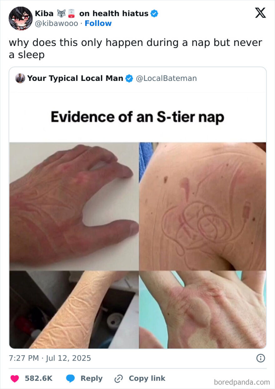 Humorous meme showing skin marks from an S-tier nap, featured in popular memes to break your doomscrolling cycle.
