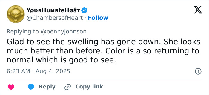 Tweet showing support for mom brutally punched and knocked out during violent Cincinnati brawl, mentioning swelling going down. Tweet showing support for mom brutally punched and knocked out during violent Cincinnati brawl, mentioning swelling going down.