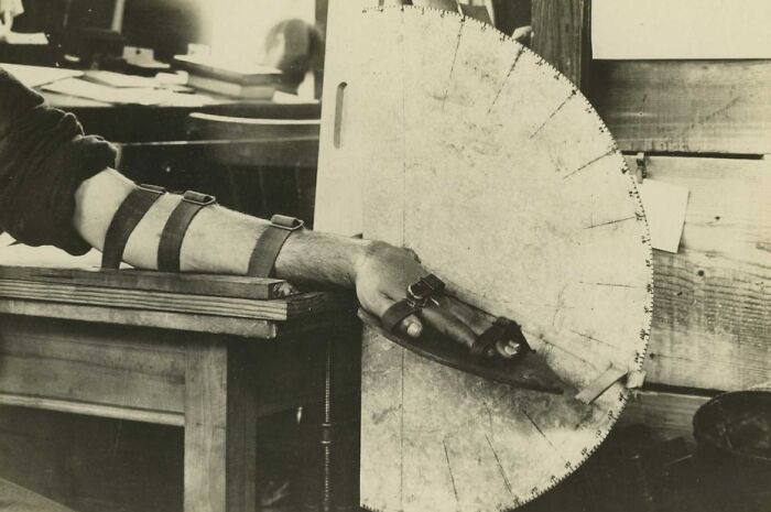 Soldier’s arm strapped to a wooden table with a measuring device, showing daily life beyond WWI trenches.