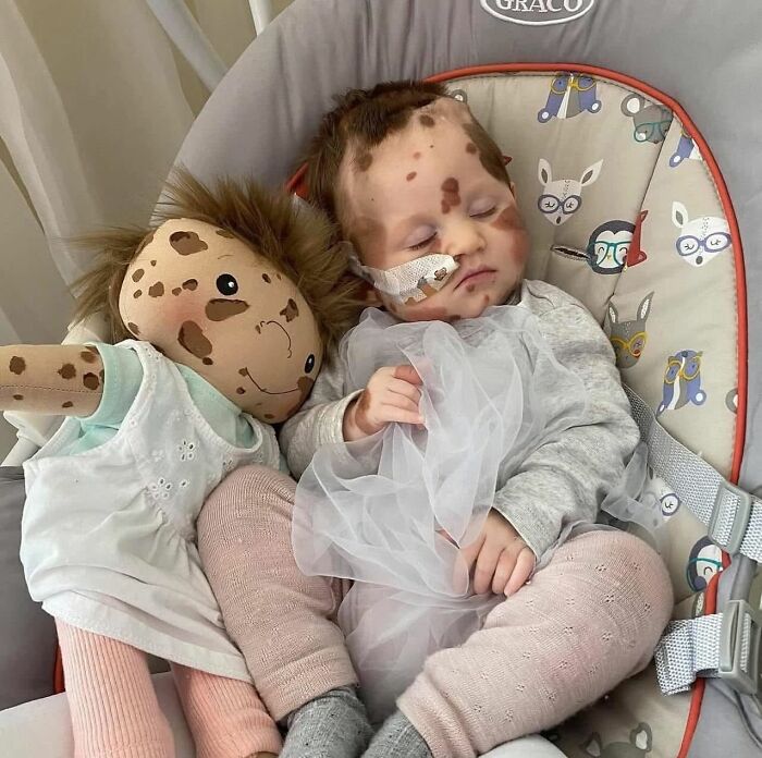 Child with rare health condition resting in a car seat next to a doll designed to represent similar unique needs.