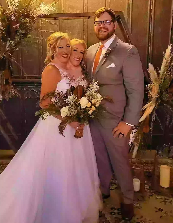 Conjoined twins Abby and Brittany Hensel in a wedding dress standing beside a man, holding a floral bouquet indoors. Conjoined twins Abby and Brittany Hensel in a wedding dress standing beside a man, holding a floral bouquet indoors.
