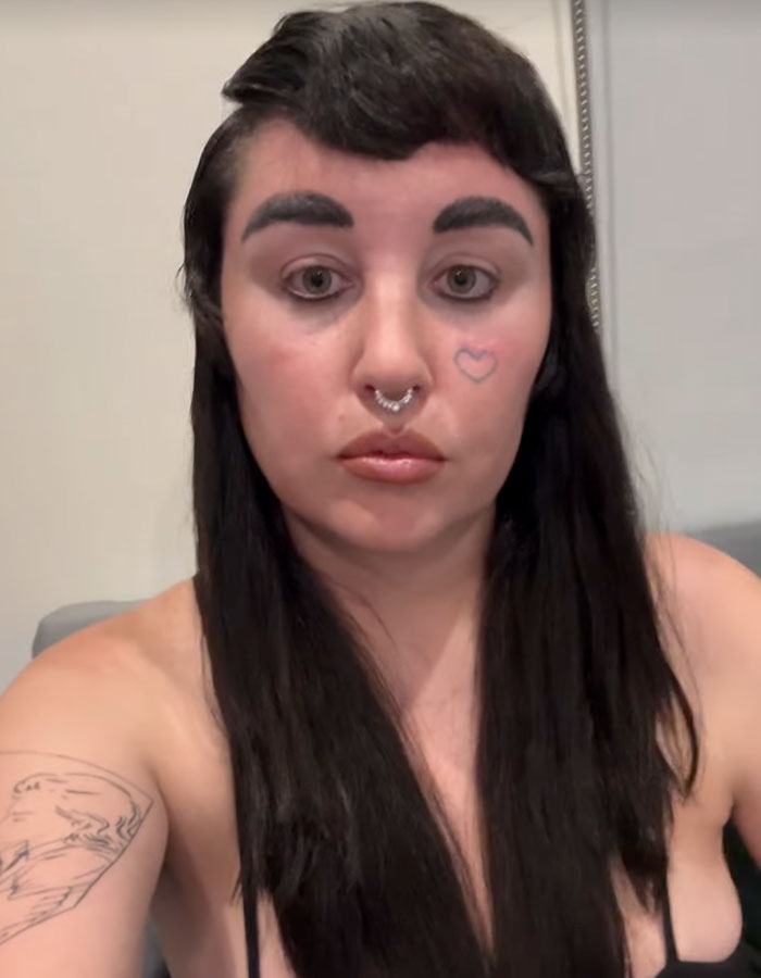 "Love The Lips": Amanda Bynes Shocks Fans With Transformation After Revealing New Cosmetic Procedures "Love The Lips": Amanda Bynes Shocks Fans With Transformation After Revealing New Cosmetic Procedures