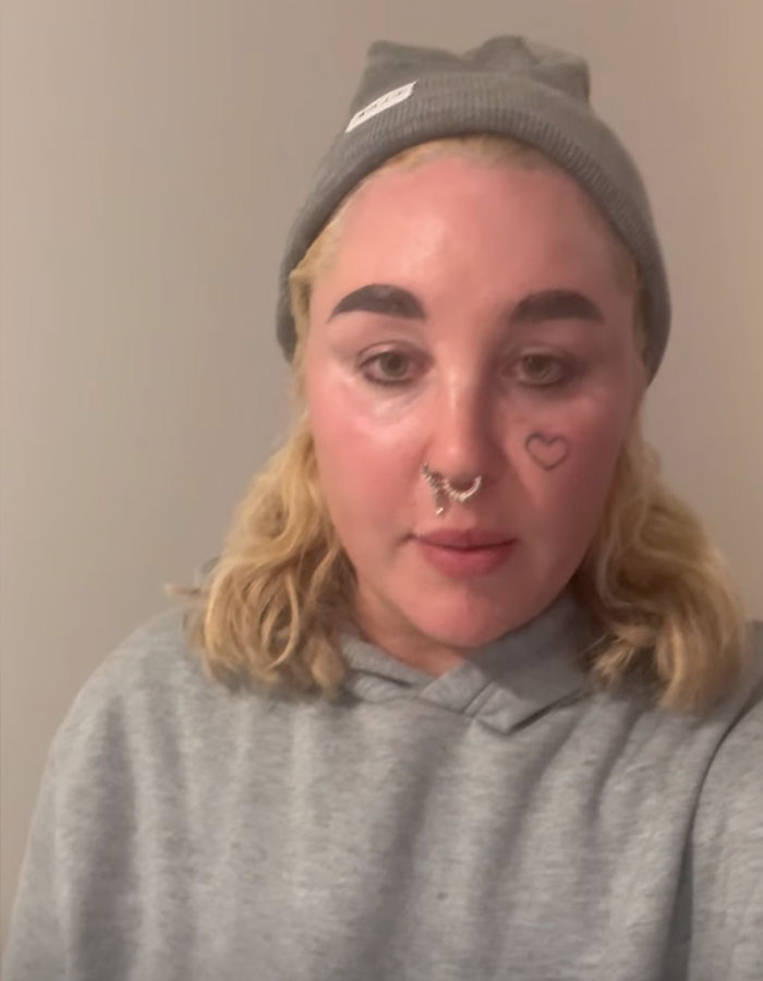 "Love The Lips": Amanda Bynes Shocks Fans With Transformation After Revealing New Cosmetic Procedures "Love The Lips": Amanda Bynes Shocks Fans With Transformation After Revealing New Cosmetic Procedures