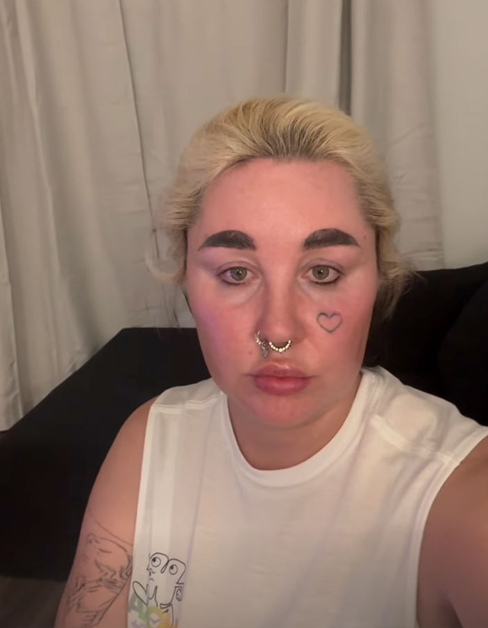 "Love The Lips": Amanda Bynes Shocks Fans With Transformation After Revealing New Cosmetic Procedures "Love The Lips": Amanda Bynes Shocks Fans With Transformation After Revealing New Cosmetic Procedures