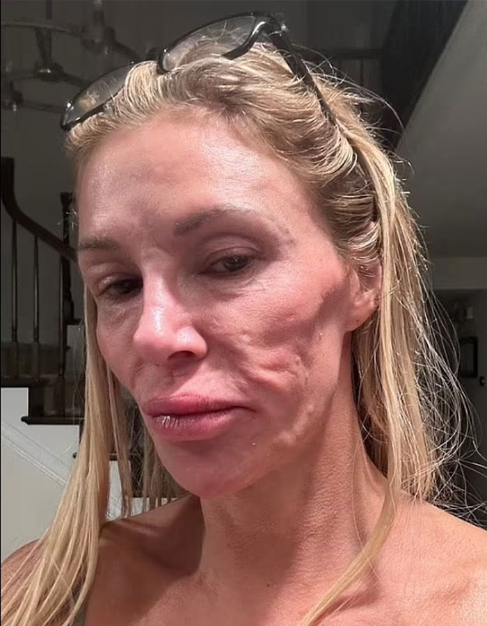 Brandi Glanville Reveals New Smile After $130K Health Battle And Face-Disfiguring Parasite Brandi Glanville Reveals New Smile After $130K Health Battle And Face-Disfiguring Parasite