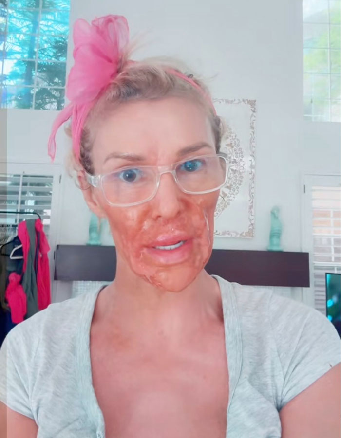 Brandi Glanville Reveals New Smile After $130K Health Battle And Face-Disfiguring Parasite Brandi Glanville Reveals New Smile After $130K Health Battle And Face-Disfiguring Parasite