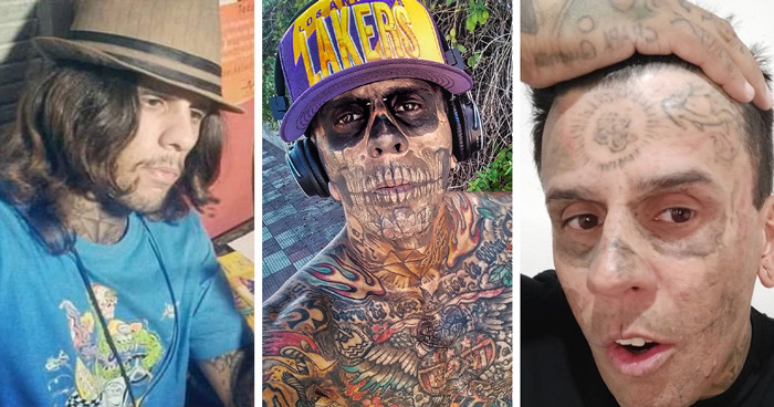 Brazilian Steve-O showing dramatic transformation after tattoo removal on his heavily tattooed face and body. Brazilian Steve-O showing dramatic transformation after tattoo removal on his heavily tattooed face and body.