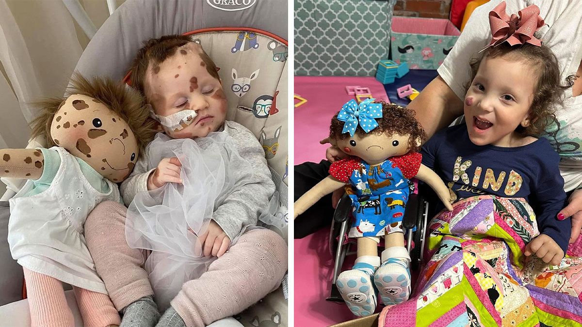 Child with rare health condition holding a custom doll designed to represent their unique needs and appearance.