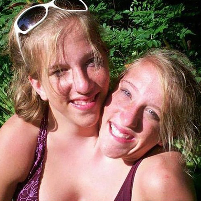 Hensel twins smiling outdoors, embracing each other, sparking discussion about motherhood and marriage. Hensel twins smiling outdoors, embracing each other, sparking discussion about motherhood and marriage.