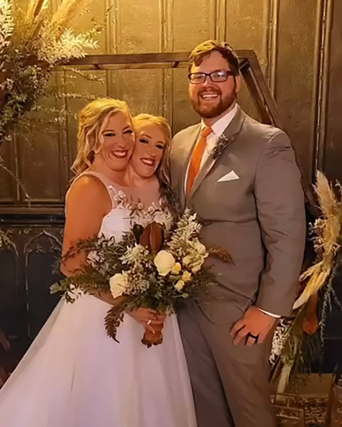 Hensel twins smiling with groom, holding wedding bouquets, sparking speculation about motherhood and marriage. Hensel twins smiling with groom, holding wedding bouquets, sparking speculation about motherhood and marriage.