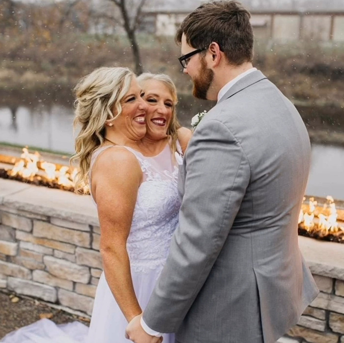 Hensel twins in wedding dresses holding hands with groom outdoors near fire pit, highlighting motherhood and marriage. Hensel twins in wedding dresses holding hands with groom outdoors near fire pit, highlighting motherhood and marriage.