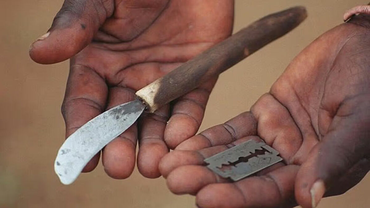 Hands holding a crude knife and razor blade used in a mass circumcision ceremony with tragic injuries reported.