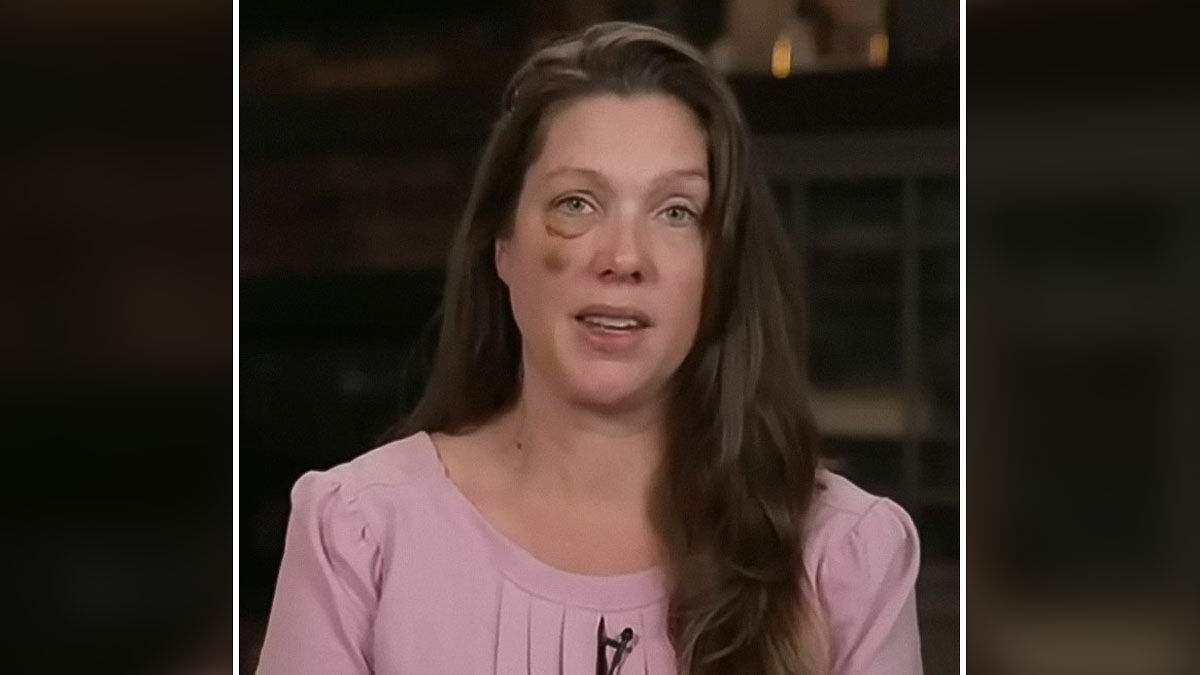 Single mom with visible bruises on face speaks out after brutal beating by Cincinnati mob.