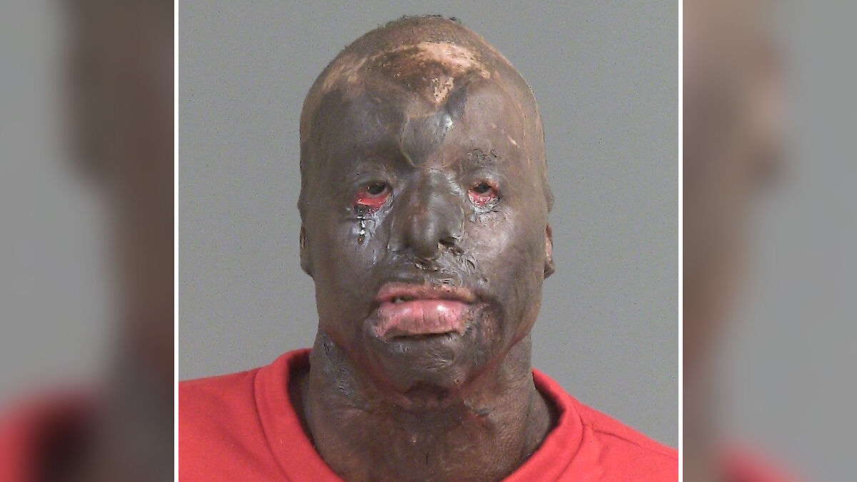 Mugshot of man with severe facial scars, resembling a Batman villain, after turning himself in for homicide.