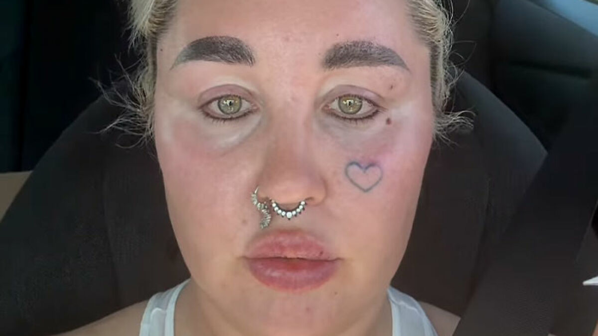 Amanda Bynes close-up showing dramatic change after controversial Kylie Jenner style procedure in a car seat.