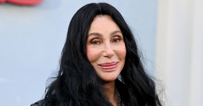 Cher’s ‘Melting’ Appearance Sparks Concern As Her Friends Break Silence On Her Plastic Surgery ‘Indulgence’