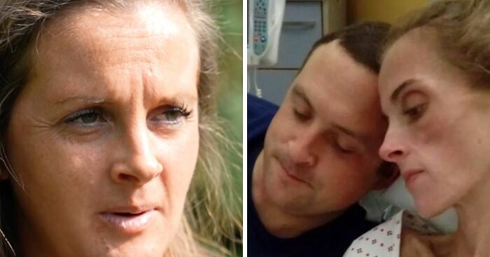 “It Felt Like An Axe”: Doctors Dismissed Her Pain For Years Until Scans Revealed Rare Disorder