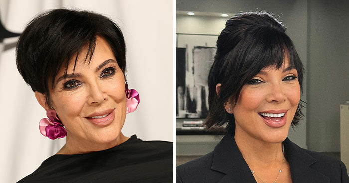 “Starting To Look Like Michael Jackson”: Kris Jenner Defends Viral Facelift As “Aging Gracefully”