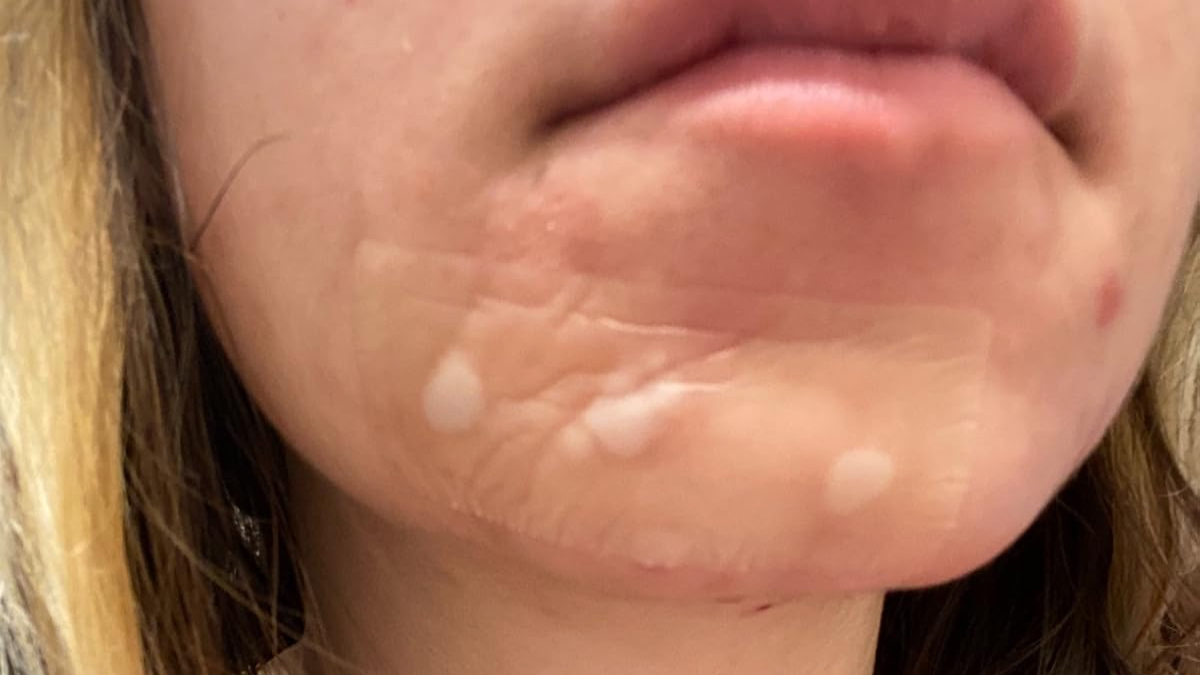 Close up of a person's chin with smooth skin patches, highlighting discreet packaging benefits at self-checkout aisles.