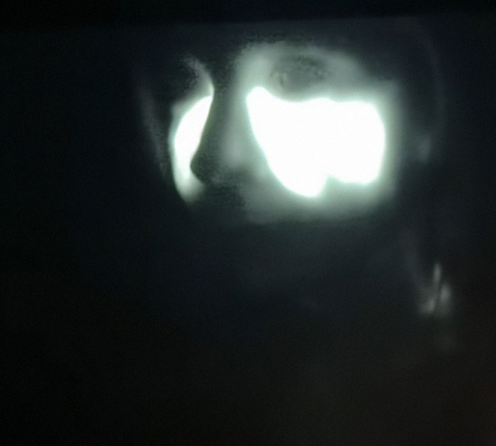 Close-up of a partially obscured face with light illuminating contours, symbolizing concerns about Love Island face trend. Close-up of a partially obscured face with light illuminating contours, symbolizing concerns about Love Island face trend.