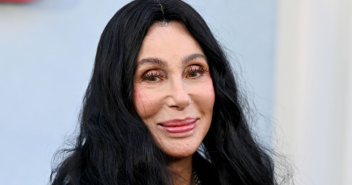 Cher's 'Melting' Appearance Has Her Friends Concerned Over Her Plastic