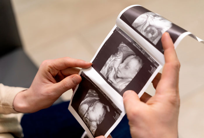 Hands holding ultrasound images of a baby, highlighting concerns related to genetic condition pregnant sister. Hands holding ultrasound images of a baby, highlighting concerns related to genetic condition pregnant sister.