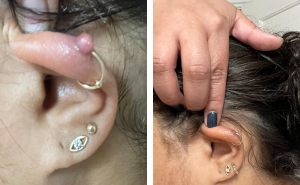 19 Gross-But-Genius Products That People Actually Swear By For Their Body Issues 