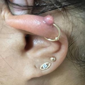 19 Gross-But-Genius Products That People Actually Swear By For Their Body Issues 