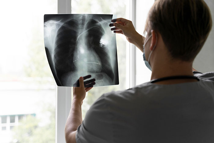 Doctor wearing a mask examining a chest X-ray highlighting surprising body quirks in human anatomy by the window.