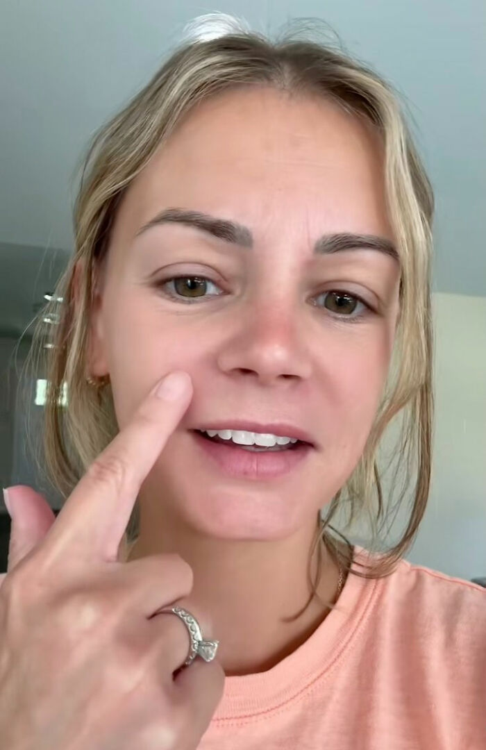 Mom Ends Up in Urgent Care After Popping Pimple In The “Triangle Of Death” Mom Ends Up in Urgent Care After Popping Pimple In The “Triangle Of Death”