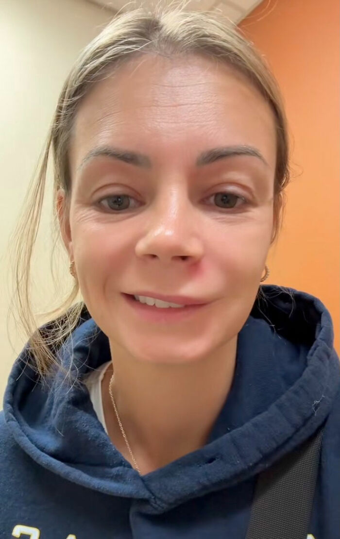 Mom Ends Up in Urgent Care After Popping Pimple In The “Triangle Of Death” Mom Ends Up in Urgent Care After Popping Pimple In The “Triangle Of Death”