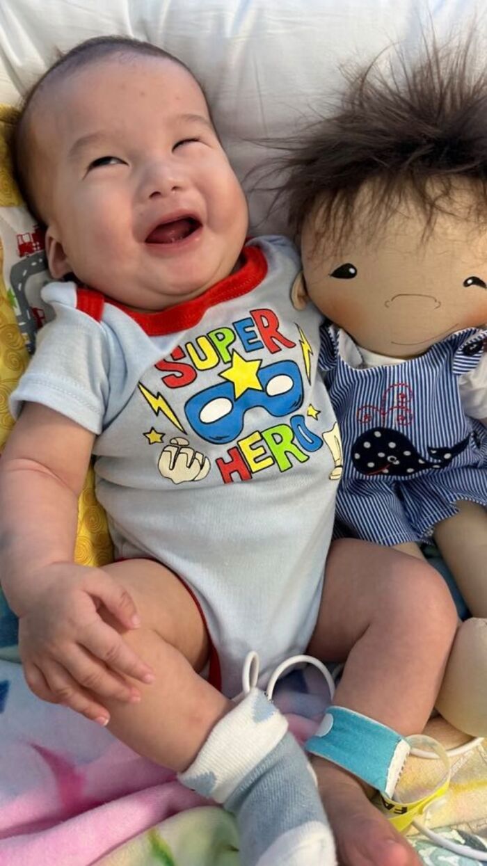 Baby smiling next to a doll representing rare health conditions, showcasing custom dolls fitting each child’s needs.