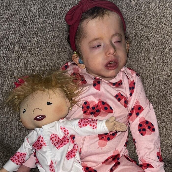 Child with rare health condition holding a custom doll designed to represent their unique needs and condition.