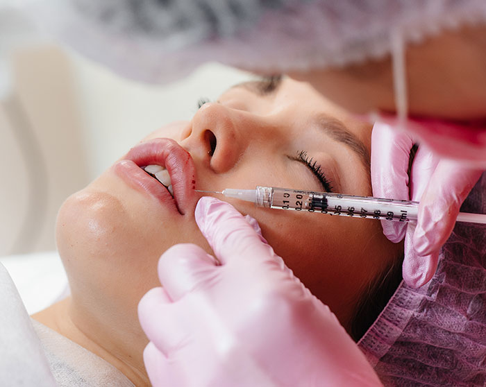 Close-up of a woman receiving lip filler injection, highlighting the Love Island face trend and filler concerns from experts. Close-up of a woman receiving lip filler injection, highlighting the Love Island face trend and filler concerns from experts.