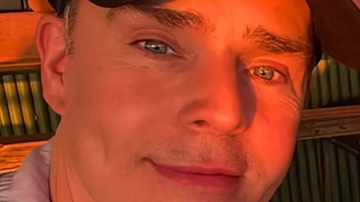 Close-up of a man showing facial details after a facelift procedure in Mexico with a warm sunlight glow.