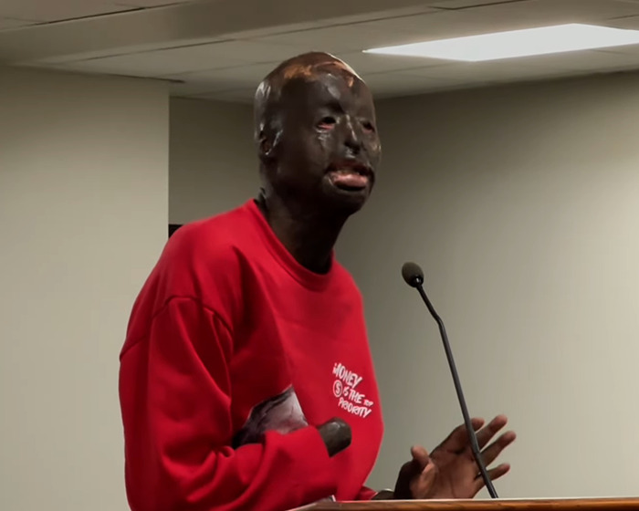 Man with severe burn scars wearing red sweatshirt speaks at podium, linked to Batman villain story and homicide case. Man with severe burn scars wearing red sweatshirt speaks at podium, linked to Batman villain story and homicide case.