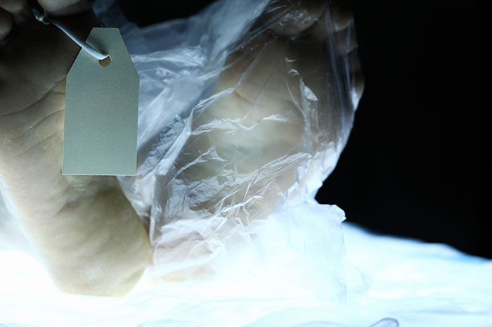 50 Strange Things Autopsy Doctors Have Discovered On The Job