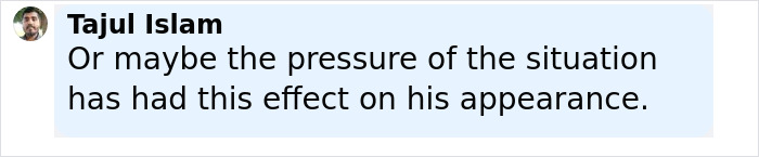 "Love The Lips": Amanda Bynes Shocks Fans With Transformation After Revealing New Cosmetic Procedures "Love The Lips": Amanda Bynes Shocks Fans With Transformation After Revealing New Cosmetic Procedures