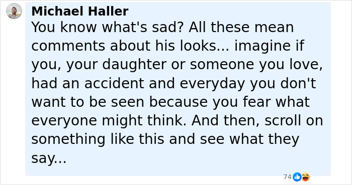 User comment expressing sadness over mean comments about someone's looks after an accident, related to Batman villain story. User comment expressing sadness over mean comments about someone's looks after an accident, related to Batman villain story.