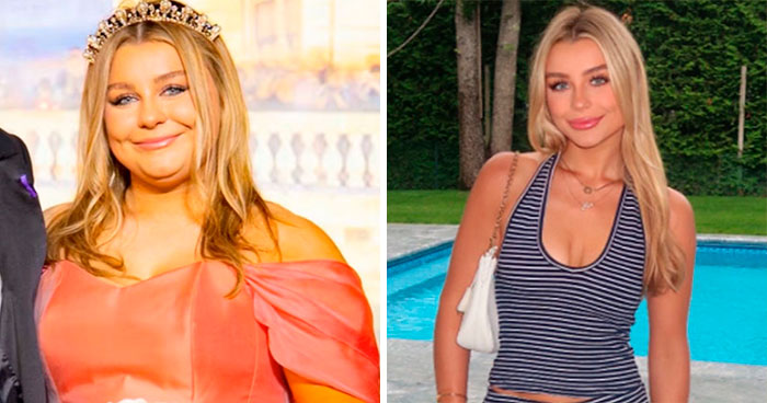 42 People Who Are Not The Same As Before Share Comparison Pics