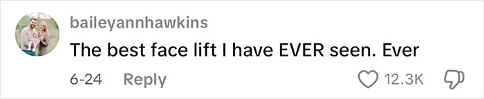 Comment text praising the best face lift ever seen, posted by user baileyannhawkins with 12.3K likes on a social media platform. Comment text praising the best face lift ever seen, posted by user baileyannhawkins with 12.3K likes on a social media platform.