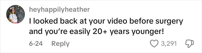 Comment praising a 51-year-old’s face lift results, noting she looks 20+ years younger after surgery. Comment praising a 51-year-old’s face lift results, noting she looks 20+ years younger after surgery.
